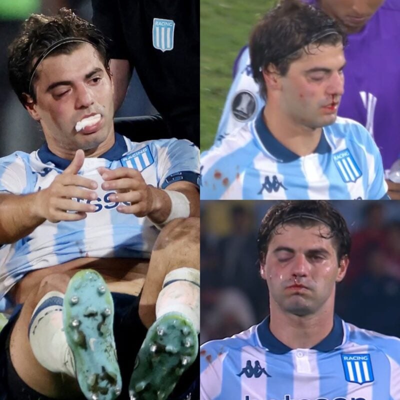 Sosa en Racing operación